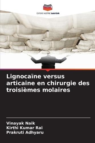 Lignocaïne versus articaine en chirurgie des troisièmes molaires