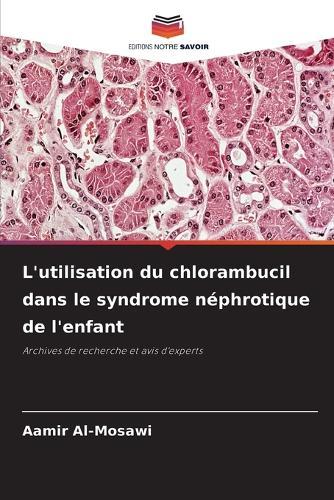 L'utilisation du chlorambucil dans le syndrome néphrotique de l'enfant