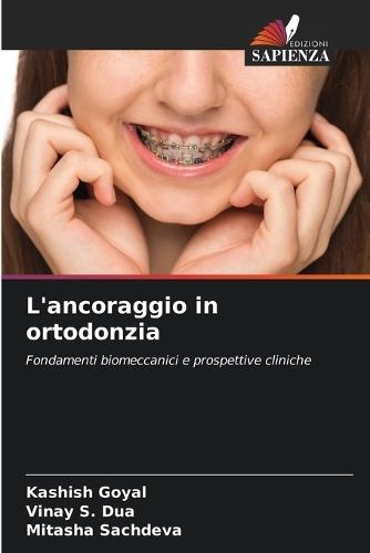 L'ancoraggio in ortodonzia