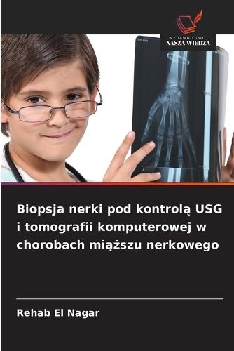 Biopsja nerki pod kontrolą USG i tomografii komputerowej w chorobach miąższu nerkowego