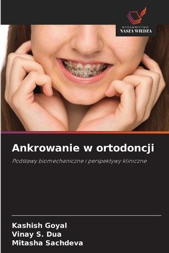 Ankrowanie w ortodoncji