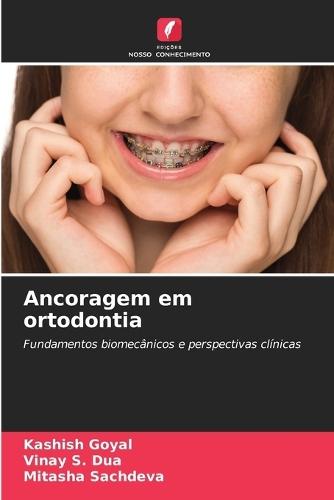 Ancoragem em ortodontia