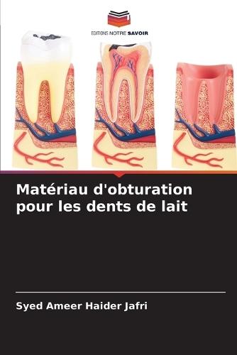 Matériau d'obturation pour les dents de lait