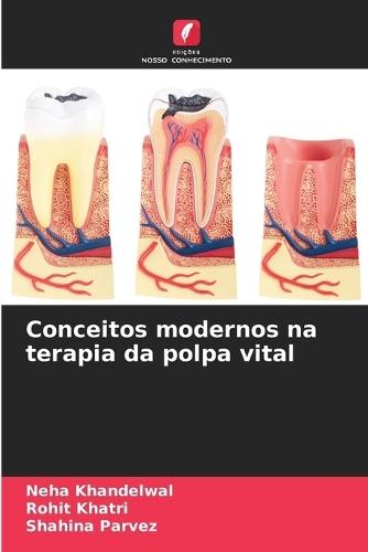 Conceitos modernos na terapia da polpa vital