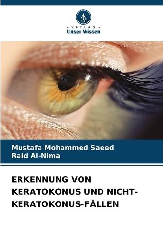 Erkennung Von Keratokonus Und Nicht-Keratokonus-Fällen