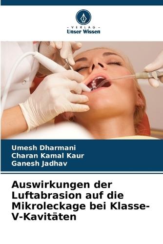 Auswirkungen der Luftabrasion auf die Mikroleckage bei Klasse-V-Kavitäten