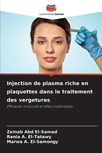 Injection de plasma riche en plaquettes dans le traitement des vergetures