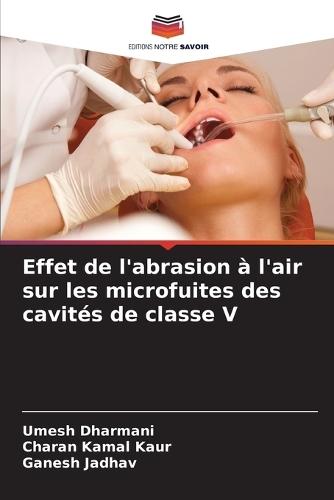 Effet de l'abrasion à l'air sur les microfuites des cavités de classe V