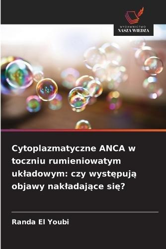 Cytoplazmatyczne ANCA w toczniu rumieniowatym ukladowym: czy występują objawy nakladające się?