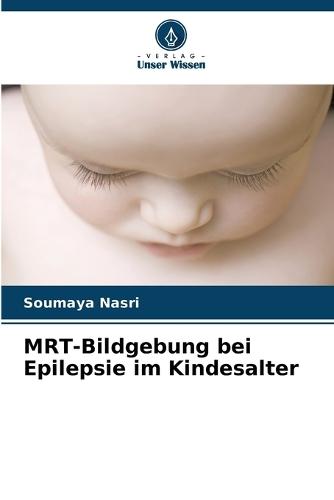 MRT-Bildgebung bei Epilepsie im Kindesalter