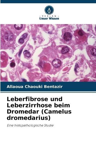 Leberfibrose und Leberzirrhose beim Dromedar (Camelus dromedarius)