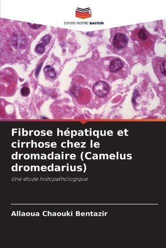 Fibrose hépatique et cirrhose chez le dromadaire (Camelus dromedarius)