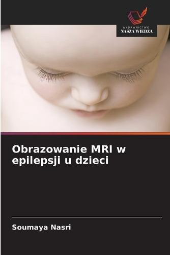 Obrazowanie MRI w epilepsji u dzieci