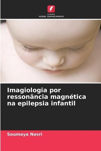 Imagiologia por ressonância magnética na epilepsia infantil