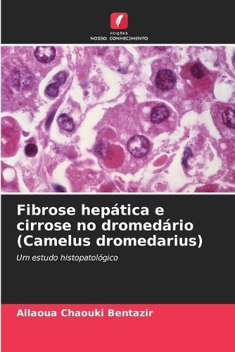 Fibrose hepática e cirrose no dromedário (Camelus dromedarius)