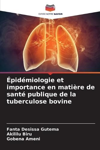 Épidémiologie et importance en matière de santé publique de la tuberculose bovine