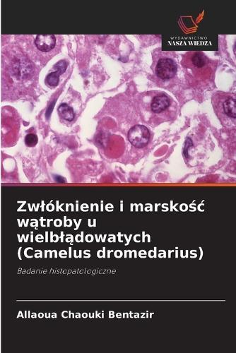 Zwlóknienie i marskośc wątroby u wielblądowatych (Camelus dromedarius)