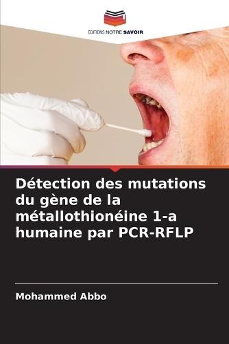 Détection des mutations du gène de la métallothionéine 1-a humaine par PCR-RFLP