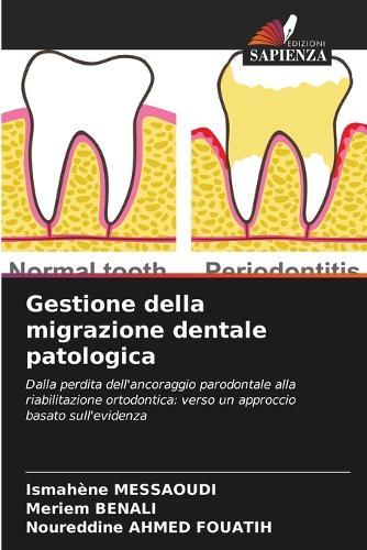 Gestione della migrazione dentale patologica