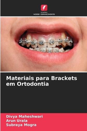 Materiais para Brackets em Ortodontia