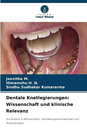 Dentale Knetlegierungen: Wissenschaft und klinische Relevanz