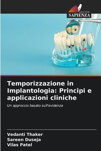 Temporizzazione in Implantologia: Principi e applicazioni cliniche