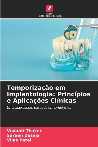 Temporização em Implantologia: Princípios e Aplicações Clínicas
