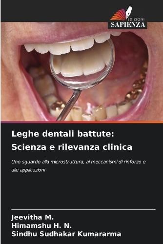 Leghe dentali battute: Scienza e rilevanza clinica