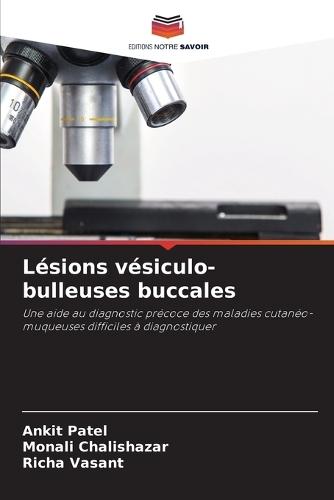 Lésions vésiculo-bulleuses buccales
