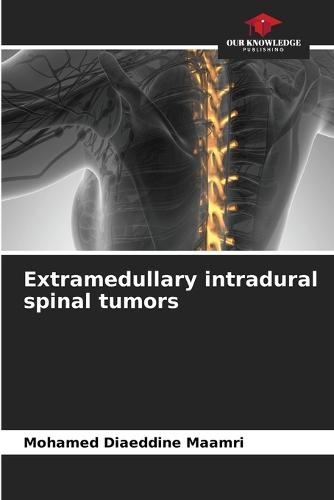 Extramedullary intradural spinal tumors
