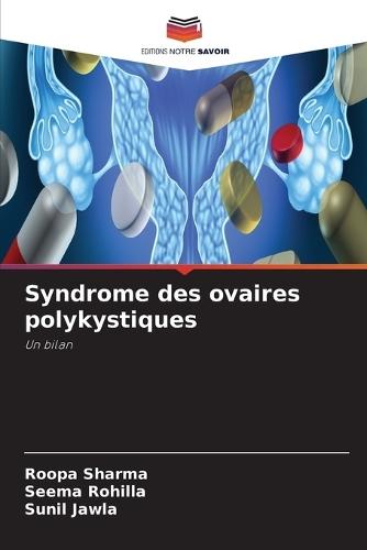 Syndrome des ovaires polykystiques