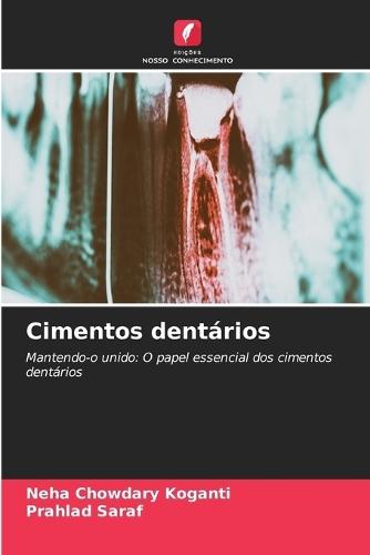Cimentos dentários