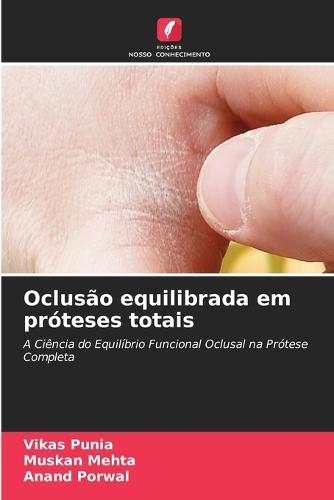 Oclusão equilibrada em próteses totais