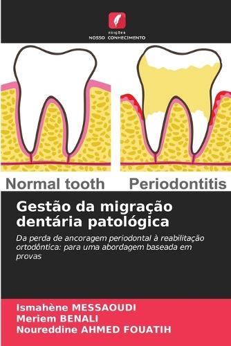 Gestão da migração dentária patológica