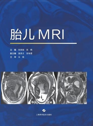 Fetal MRI/胎儿MRI