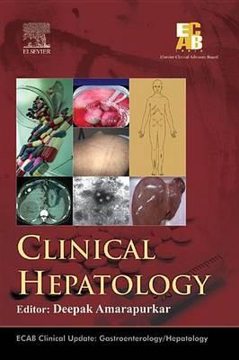 Ecab Clinical Hepatology