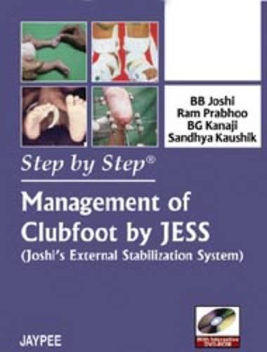 Step by Step: Management of Clubfoot by JESS (Joshi's External Stabilization System)