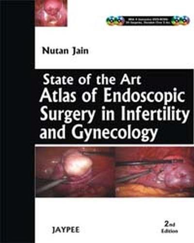State-of-the-Art Atlas of Endoscopic Surgery in Infertility and Gynecology