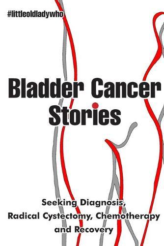 Bladder Cancer Stories: Seeking Diagnosis, Radical Cystectomy, Chemotherapy and Recovery