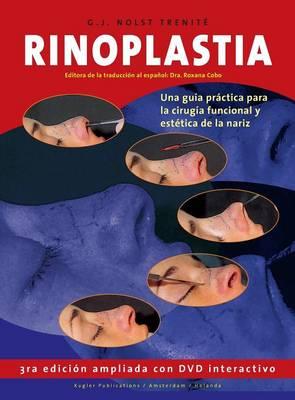 Rinoplastia