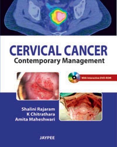 Cervical Cancer: Contemporary Management