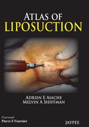 Atlas of Liposuction