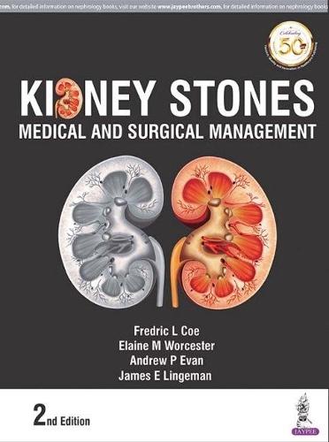 Kidney Stones: Medical and Surgical Management