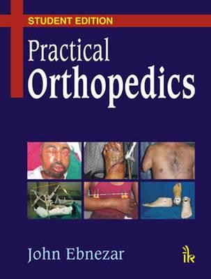 Practical Orthopedics