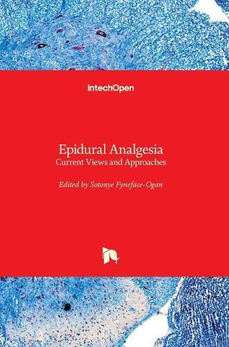 Epidural Analgesia: Current Views and Approaches