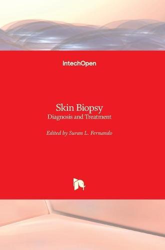 Skin Biopsy: Diagnosis and Treatment
