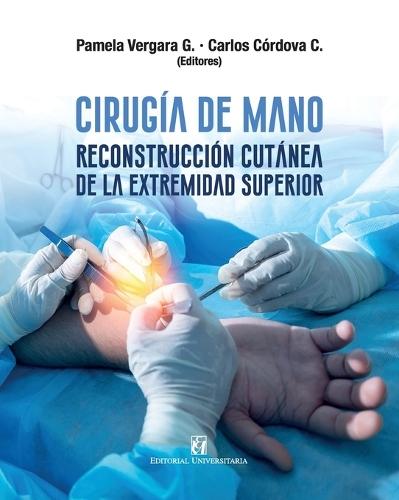 Cirugía de mano