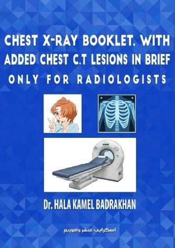 Chest X-Ray Booklet, with added Chest C.T Lesions in brief Only for Radiologists