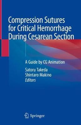 Compression Sutures for Critical Hemorrhage During Cesarean Section: A Guide by CG Animation
