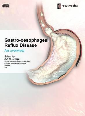 Gastro-Oesophageal Reflux Disease: An Overview